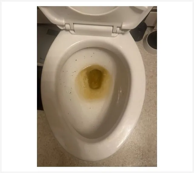 Before: Toilet before and after deep cleaning