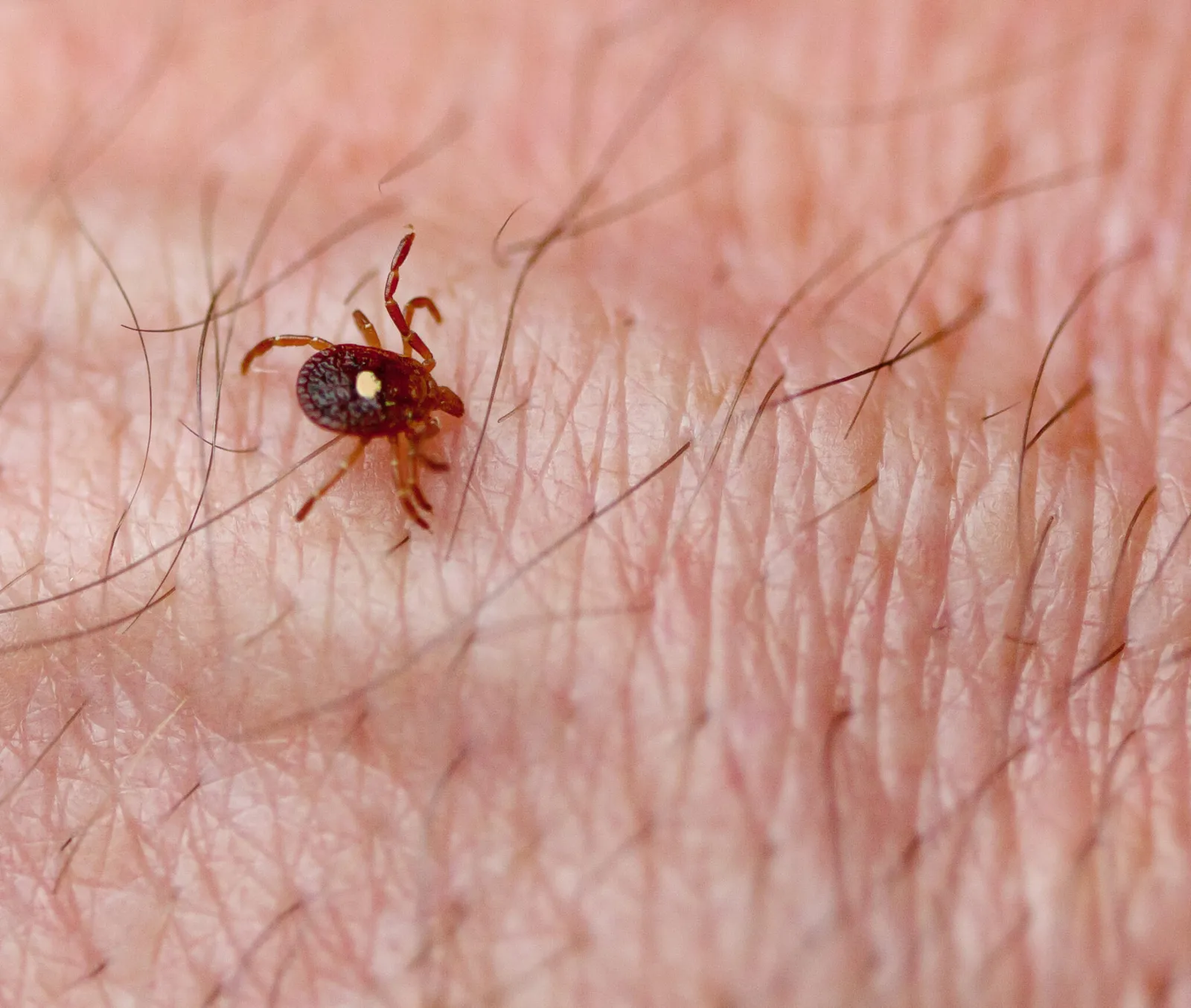 Lone Star Tick (Amblyomma americanum) on human skin