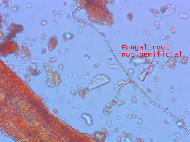 Micrograph of a fungal root, not beneficial, with a long root filament extending from it. The background shows numerous small particles and structures. The image has text indicating the root is not beneficial.