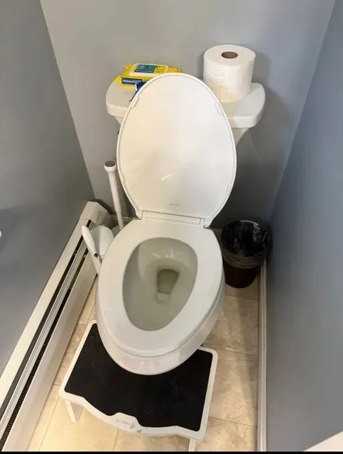 Toilet restored to spotless white after deep cleaning